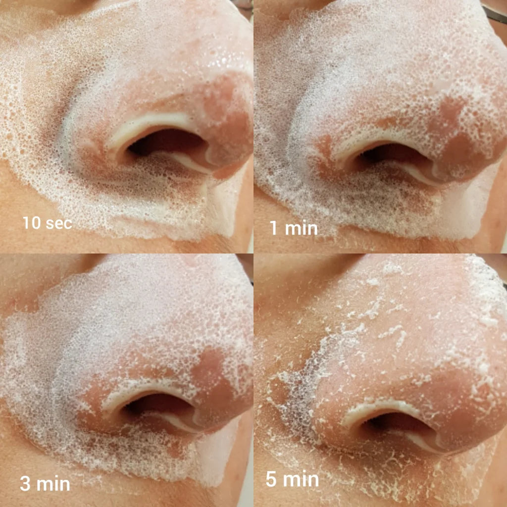 Blackhead Clearing Fizz Mask 50ml