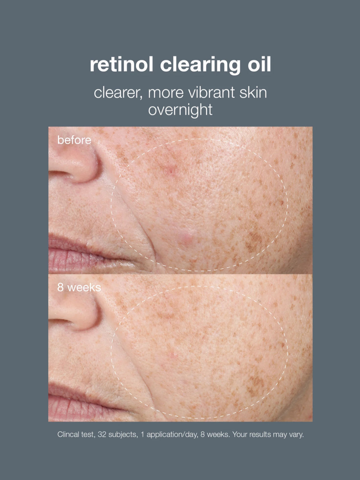 Retinol Clearing Oil