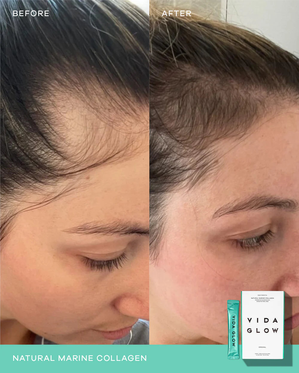 Natural Marine Collagen Sachets - Pineapple