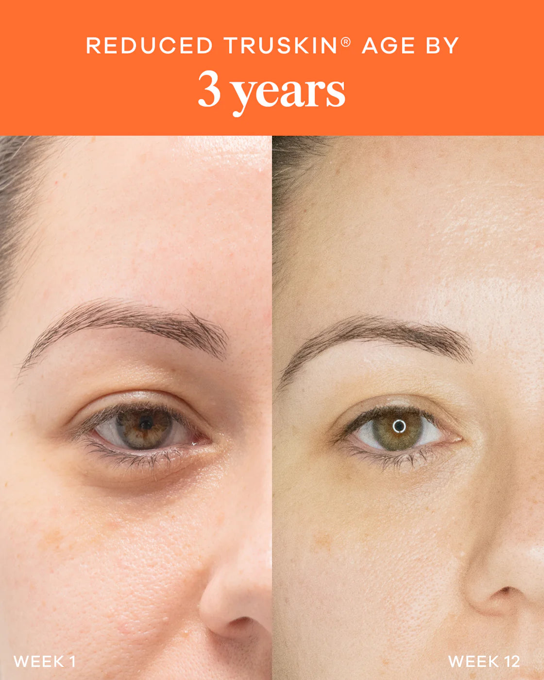 NEW Liquid Collagen - Skin + Gut Tropical