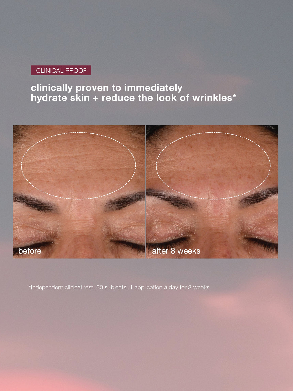 Dynamic Skin Recovery SPF50