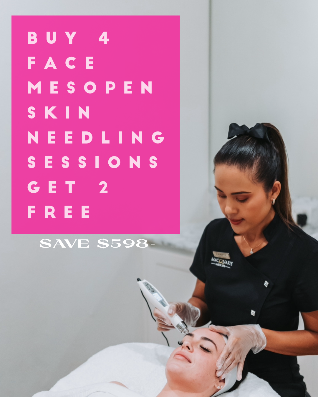 Skin Needling Buy 4 sessions get 2 FREE Skin Needling Mesopen Sessions